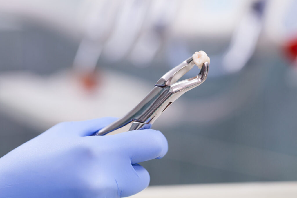 dental forceps clamping a wisdom tooth